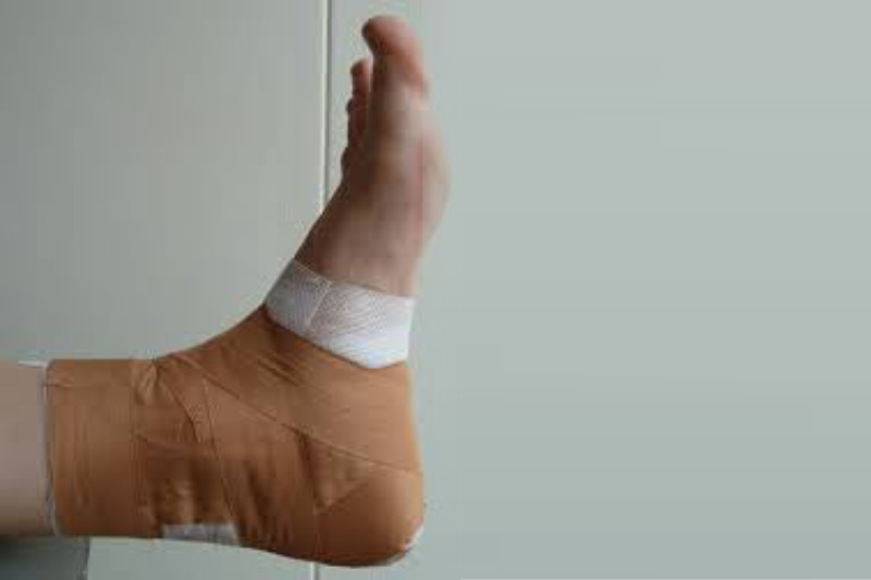 Strapping n Taping ankle Strapping n Taping ankle